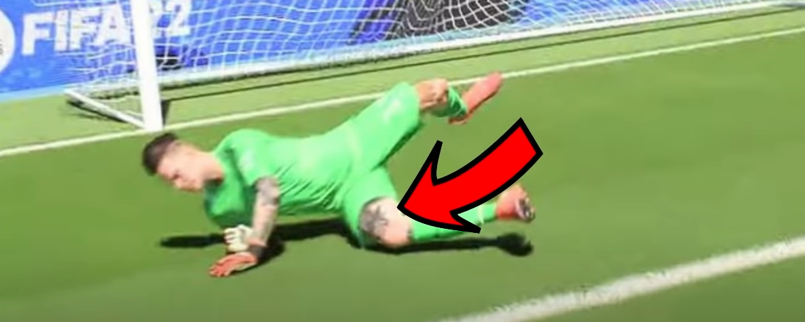 Ederson leg